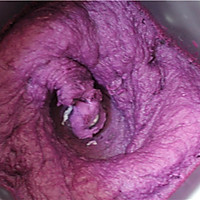 奶香紫薯糕#自己做更健康#的做法图解3