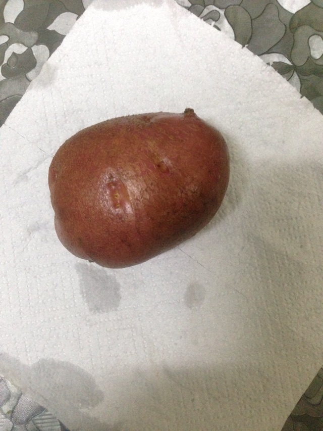 微波炉烤土豆的做法图解1