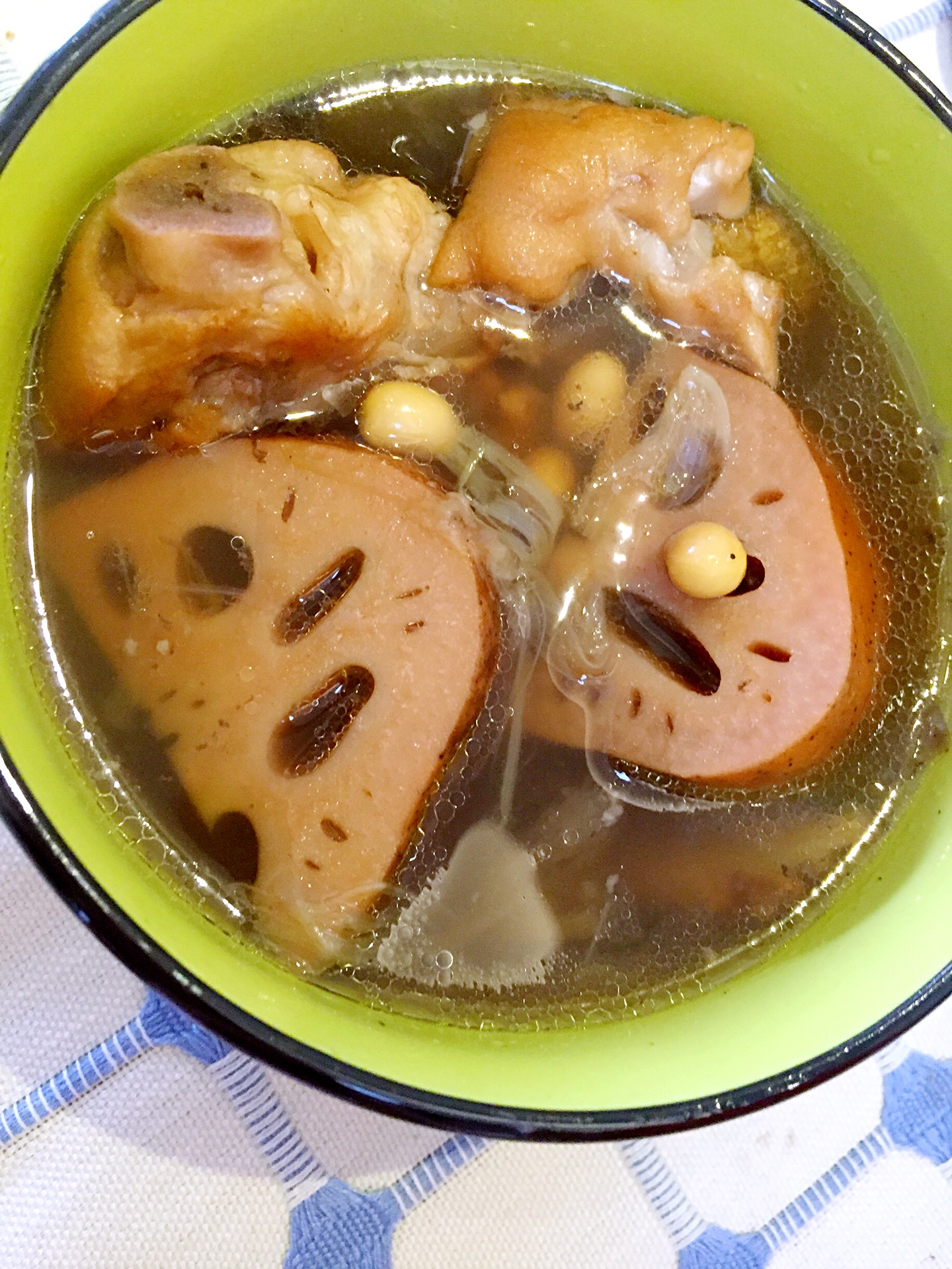 萝卜猪脚汤怎么做_萝卜猪脚汤的做法_豆果美食