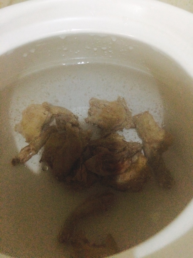 红参鸽子汤的做法图解4
