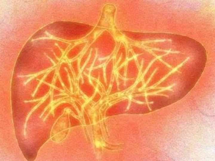 注意：秋季易肝火旺，痘痘、斑点上脸，用3方法降火消痘去斑图2